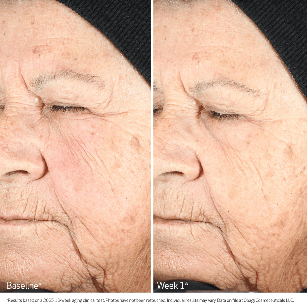 Obagi Treatments & Serums Obagi NU-GEN Cellular Renewal Serum - Skin Type Solutions
