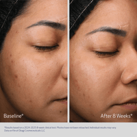 Obagi Obagi Retinol + PHA Refining Night Cream - Skin Type Solutions