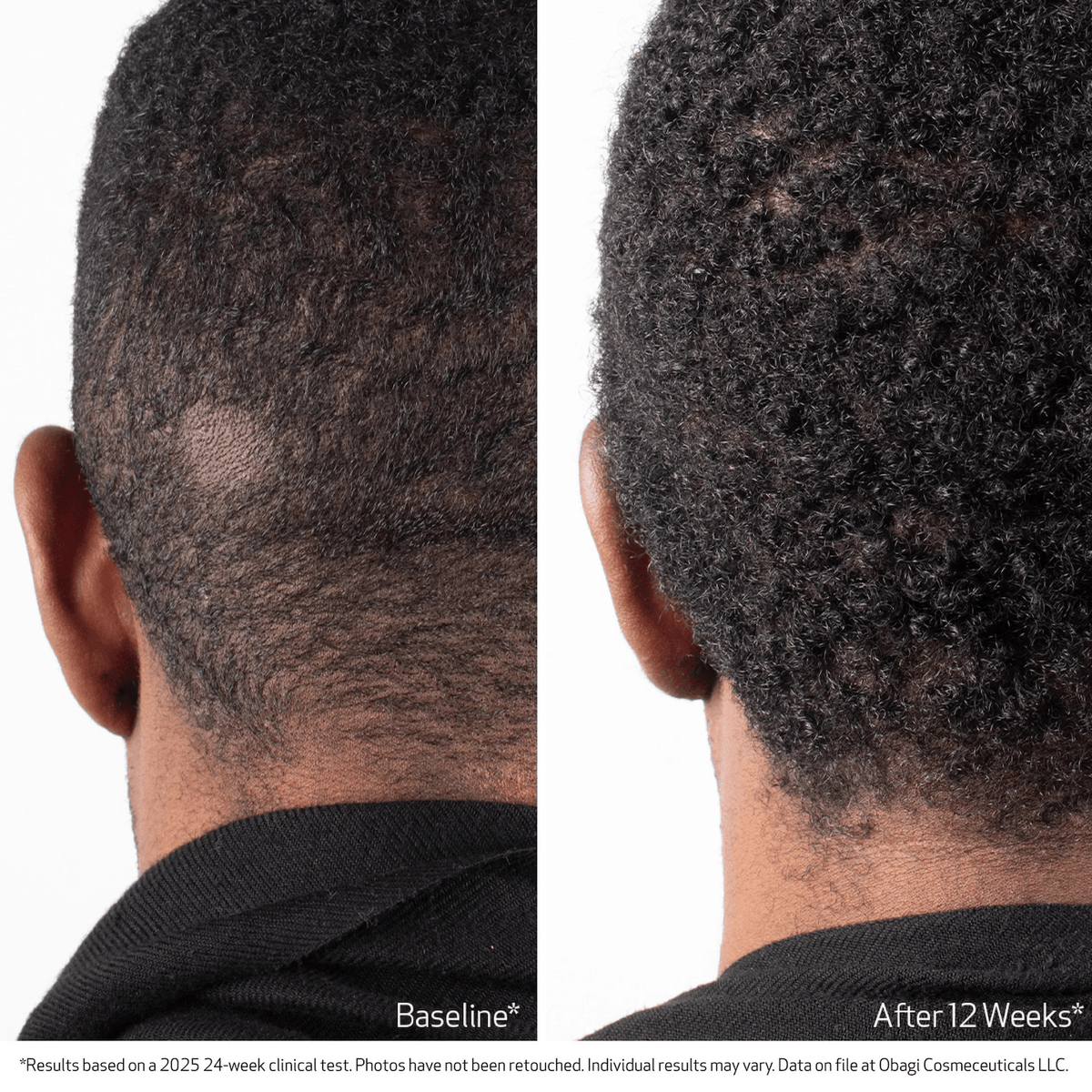 Obagi Scalp Treatment Obagi Nu-Cil BioStim Scalp Serum - Skin Type Solutions