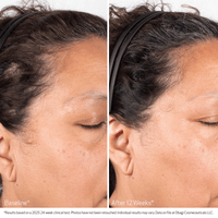Obagi Scalp Treatment Obagi Nu-Cil BioStim Scalp Serum - Skin Type Solutions