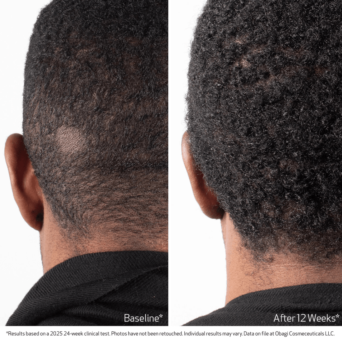 Obagi Scalp Treatment Obagi Nu-Cil BioStim Scalp Serum - Skin Type Solutions