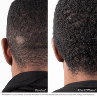 Obagi Scalp Treatment Obagi Nu-Cil BioStim Scalp Serum - Skin Type Solutions