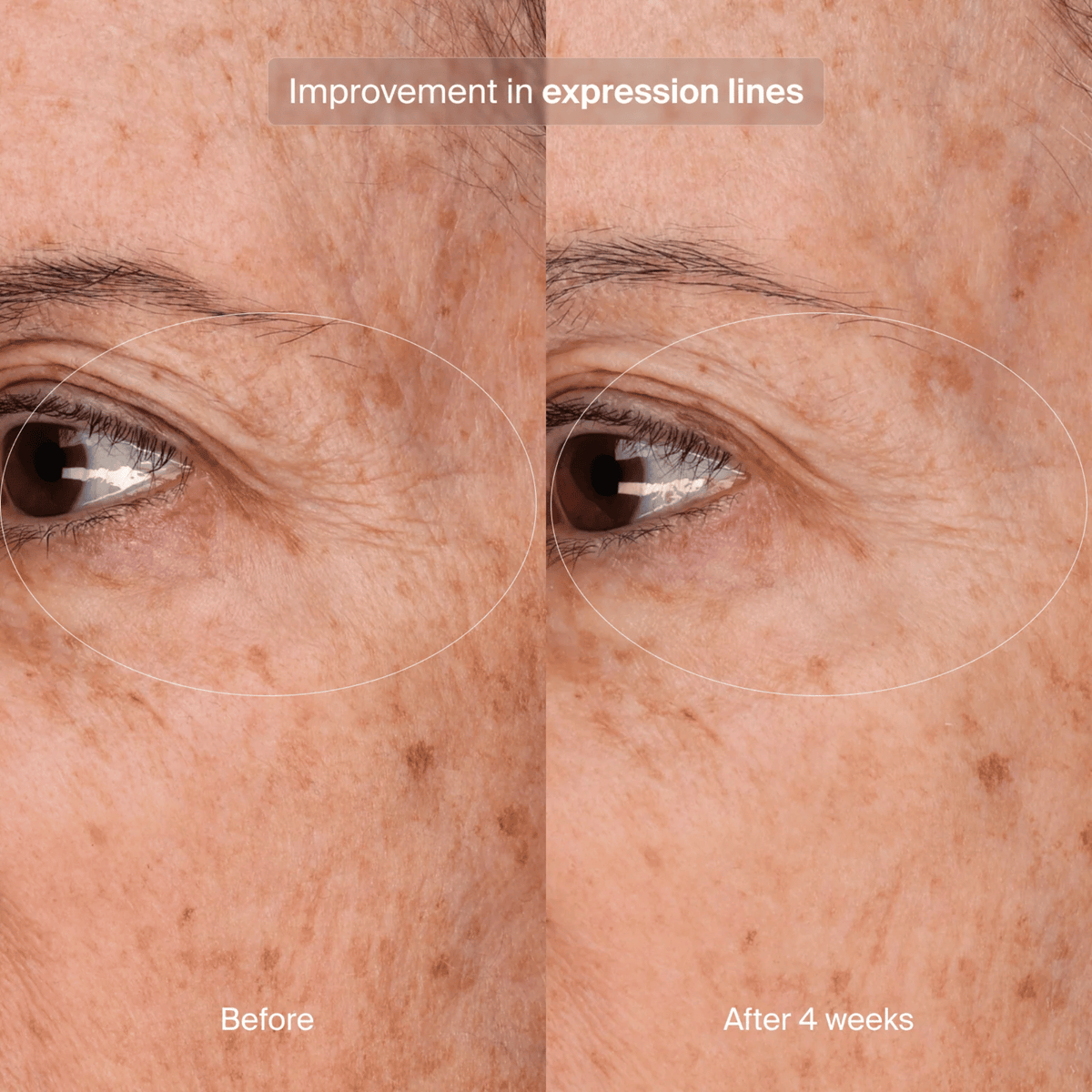 Pavise Eye Treatment Pavise Precision Eye Lift - Skin Type Solutions