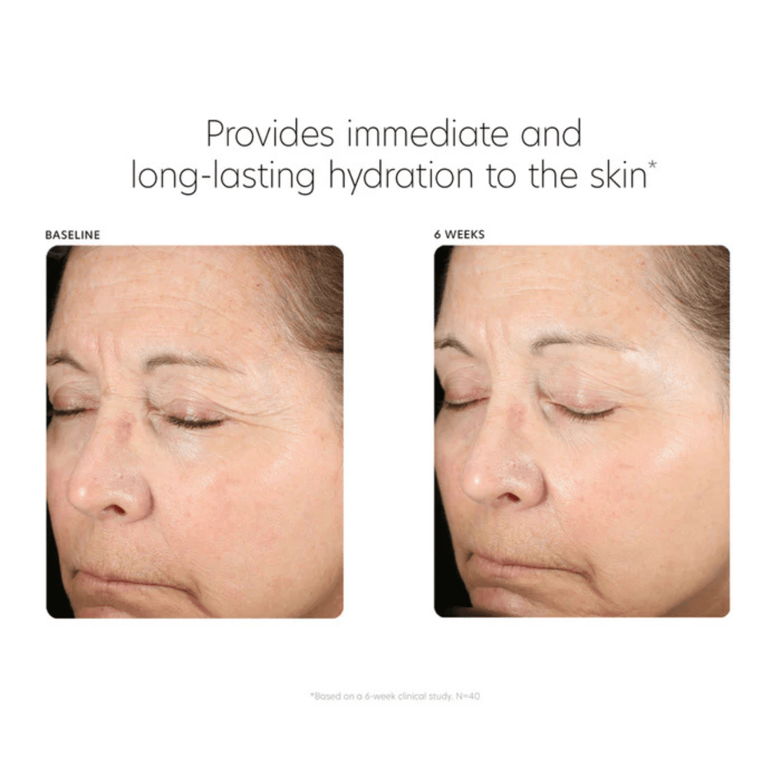 PCA Skin Facial Moisturizer PCA Skin Hyaluronic Acid Boosting Serum - Skin Type Solutions