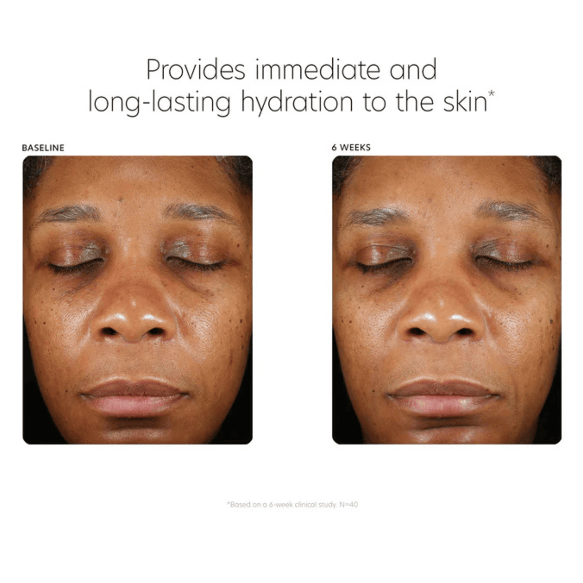 PCA Skin Facial Moisturizer PCA Skin Hyaluronic Acid Boosting Serum - Skin Type Solutions