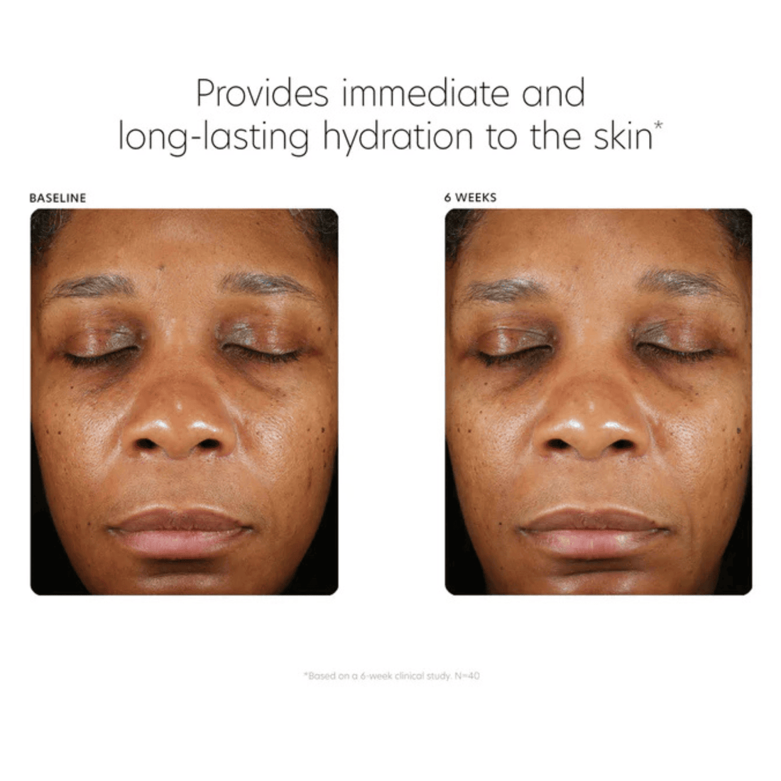 PCA Skin Facial Moisturizer PCA Skin Hyaluronic Acid Boosting Serum - Skin Type Solutions