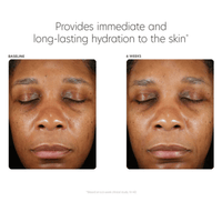 PCA Skin Facial Moisturizer PCA Skin Hyaluronic Acid Boosting Serum - Skin Type Solutions