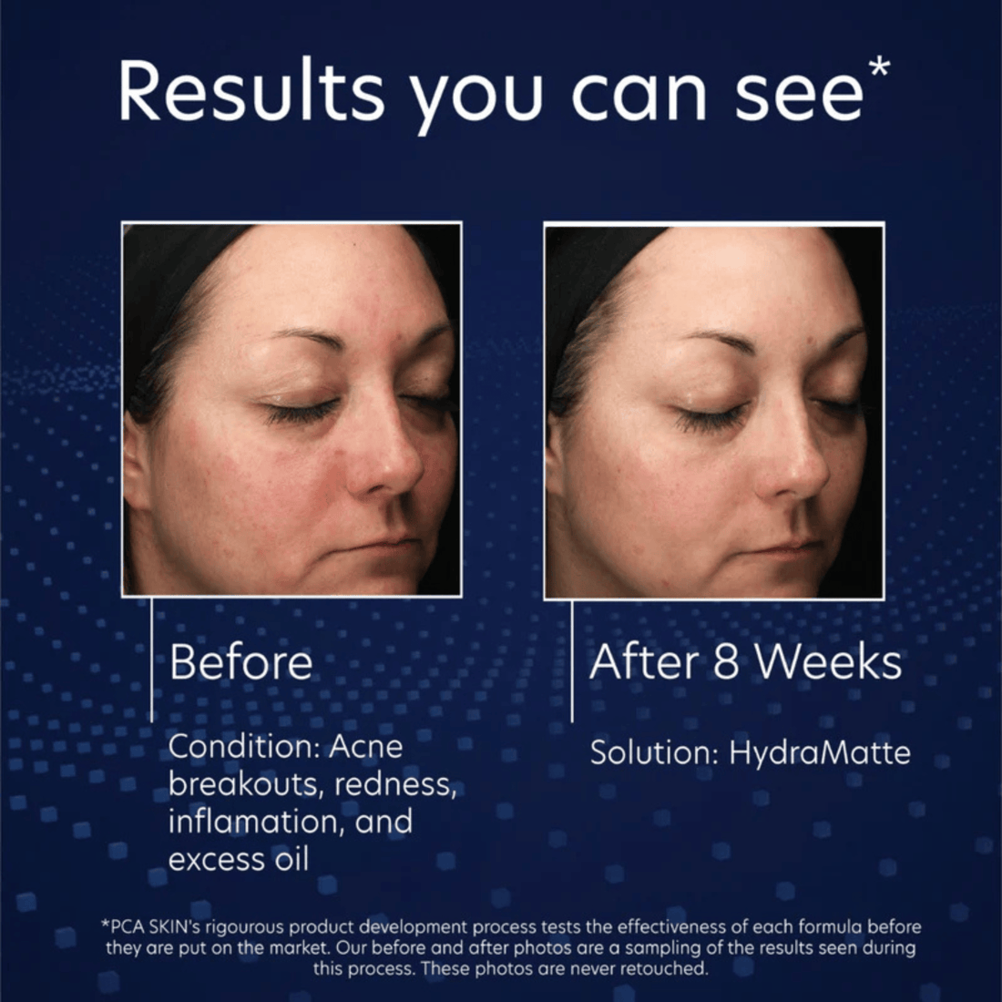 PCA Skin Facial Moisturizer 1.8 oz. PCA Skin HydraMatte - Skin Type Solutions