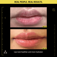 Allies Of Skin Lip Treatments Allies of Skin Peptide and Ceramide Repair Lip Balm - Skin Type Solutions