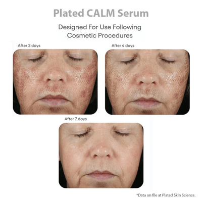 Plated Skin Science CALM Post-Procedure Serum