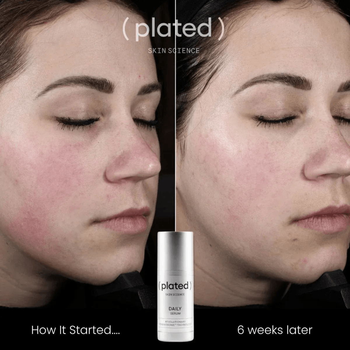Plated Skin Science Facial Moisturizer Plated SkinScience DAILY Serum - Skin Type Solutions