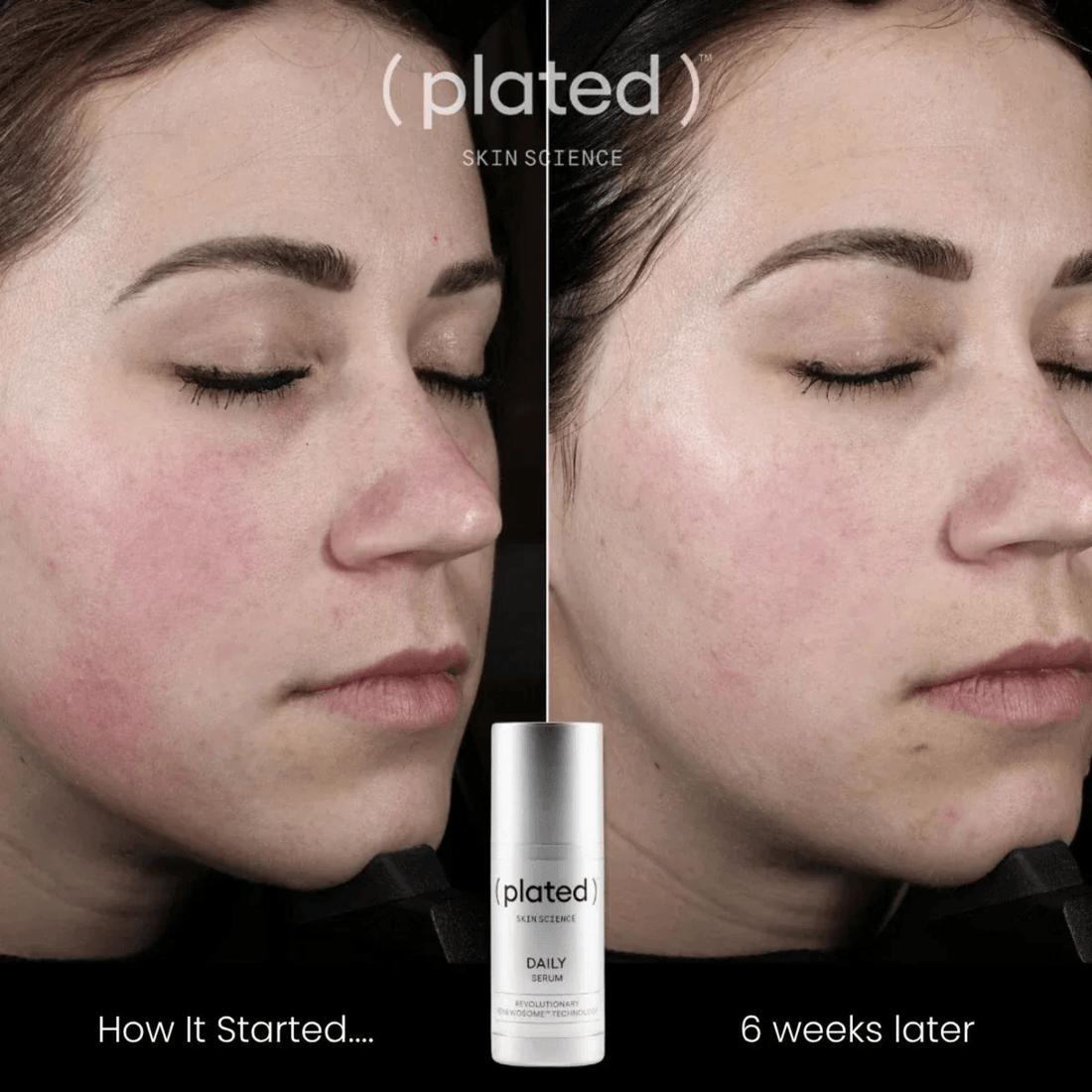 Plated Skin Science Facial Moisturizer Plated SkinScience DAILY Serum - Skin Type Solutions