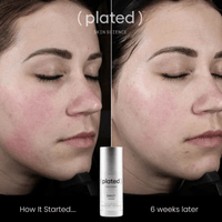 Plated Skin Science Facial Moisturizer Plated SkinScience DAILY Serum - Skin Type Solutions