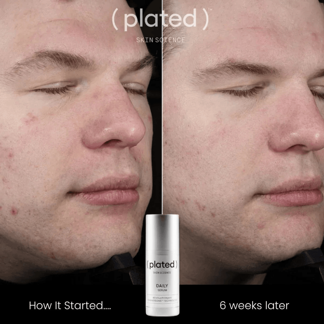 Plated Skin Science Facial Moisturizer Plated SkinScience DAILY Serum - Skin Type Solutions