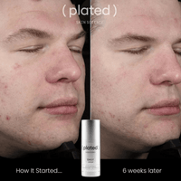 Plated Skin Science Facial Moisturizer Plated SkinScience DAILY Serum - Skin Type Solutions