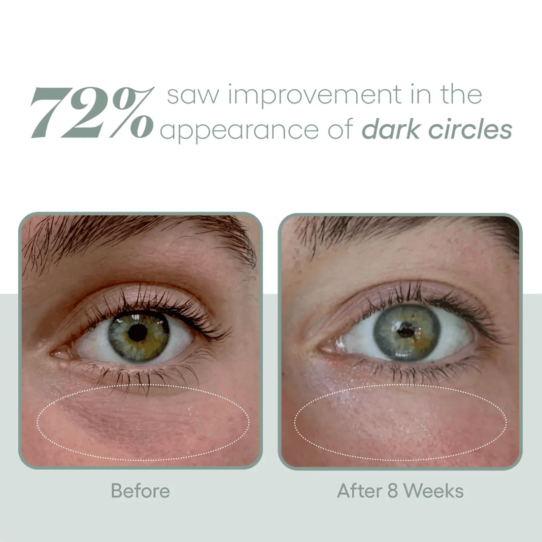 Plated Skin Science SkinCare Plated Skin Science Eye Serum - Skin Type Solutions