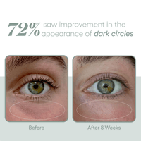 Plated Skin Science SkinCare Plated Skin Science Eye Serum - Skin Type Solutions