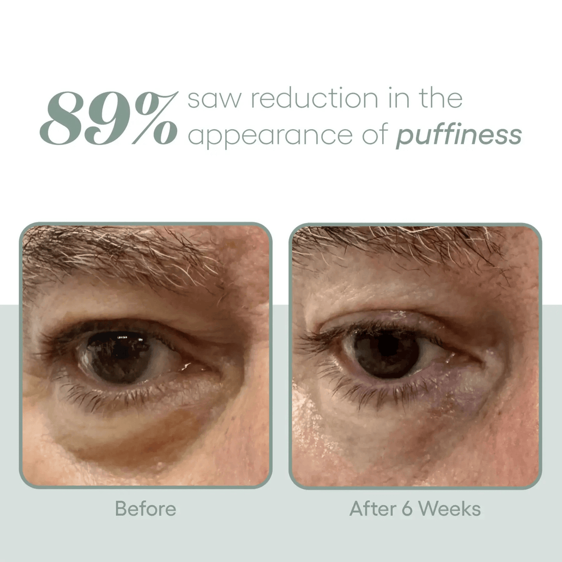 Plated Skin Science SkinCare Plated Skin Science Eye Serum - Skin Type Solutions