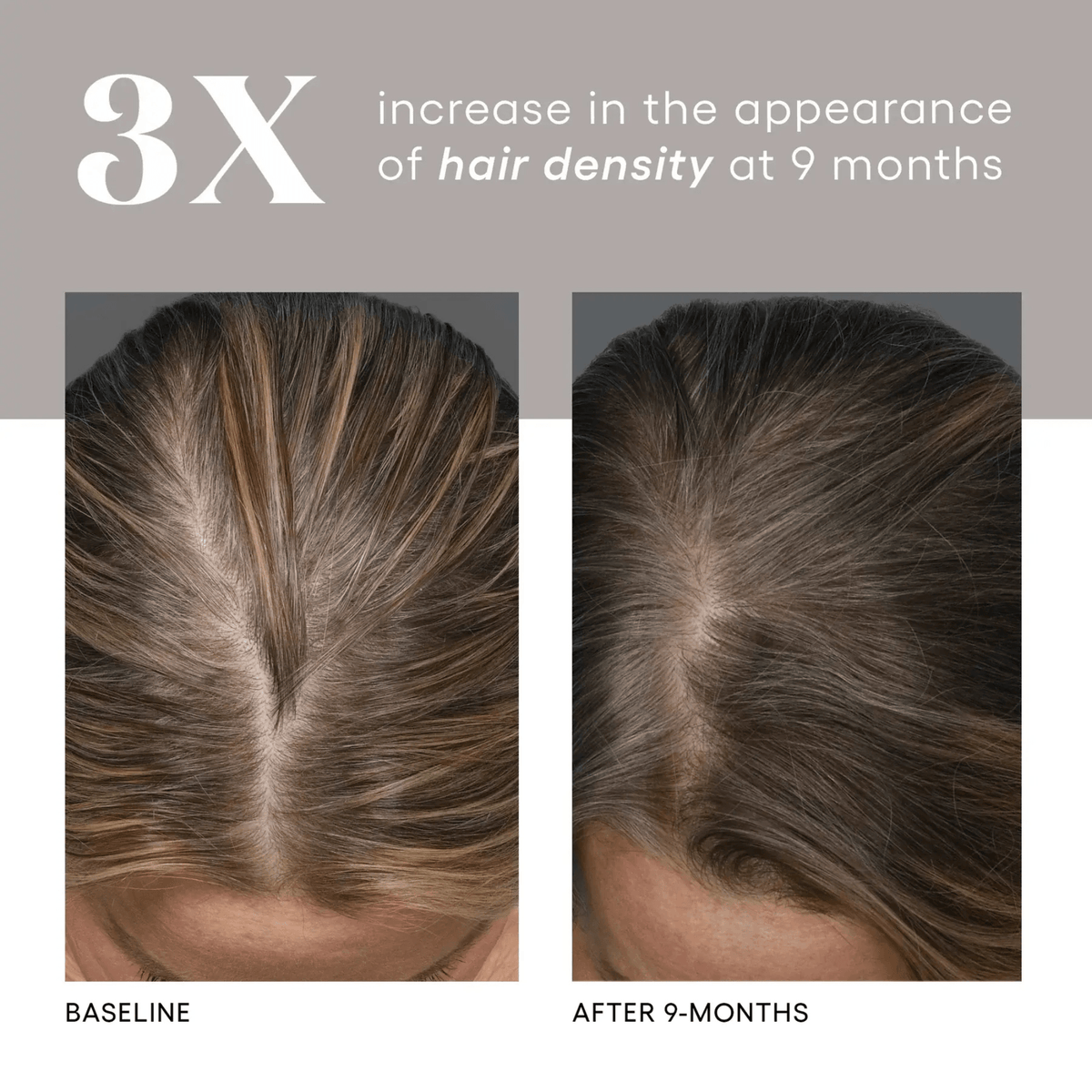 Plated Skin Science Scalp Treatment 1 fl. oz. Plated Skin Science HAIR Serum - Skin Type Solutions
