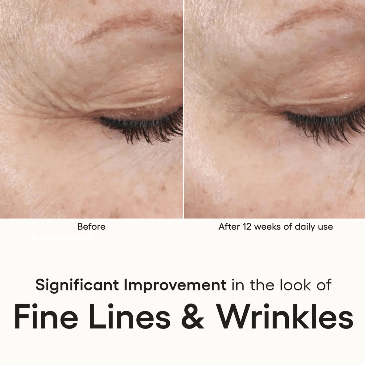 Plated Skin Science Facial Moisturizer Plated SkinScience INTENSE Serum - Skin Type Solutions