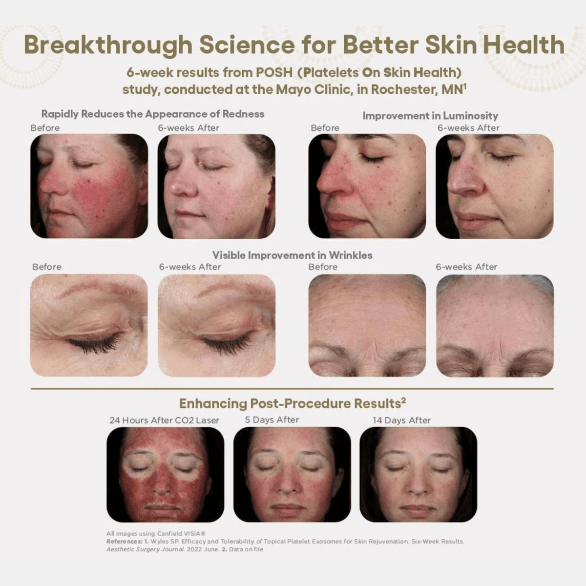 Plated Skin Science Facial Moisturizer Plated SkinScience INTENSE Serum - Skin Type Solutions
