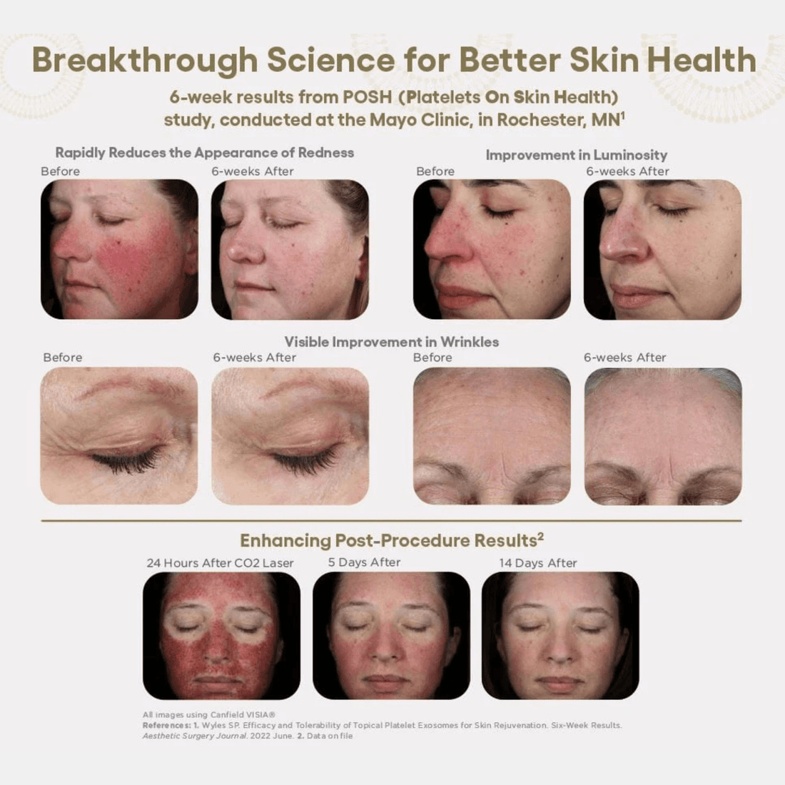 Plated Skin Science Facial Moisturizer Plated SkinScience INTENSE Serum - Skin Type Solutions