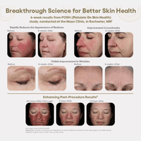 Plated Skin Science Facial Moisturizer Plated SkinScience INTENSE Serum - Skin Type Solutions