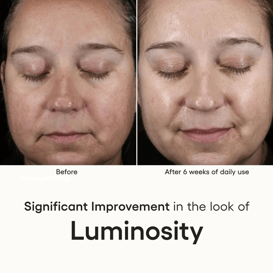 Plated Skin Science Facial Moisturizer Plated SkinScience INTENSE Serum - Skin Type Solutions