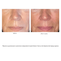 Replenix Facial Moisturizer 1.7 oz. Replenix Age Restore Nighttime Therapy - Skin Type Solutions