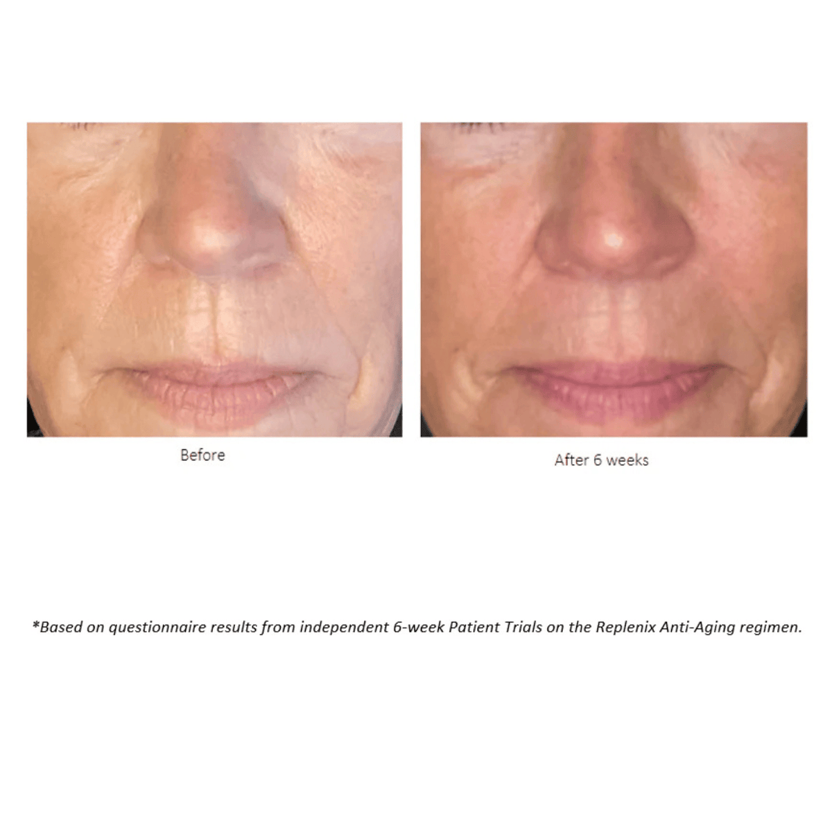 Replenix Face & Body Treatment 1 oz. Replenix Retinol 5X Regenerate Dry Serum - Skin Type Solutions