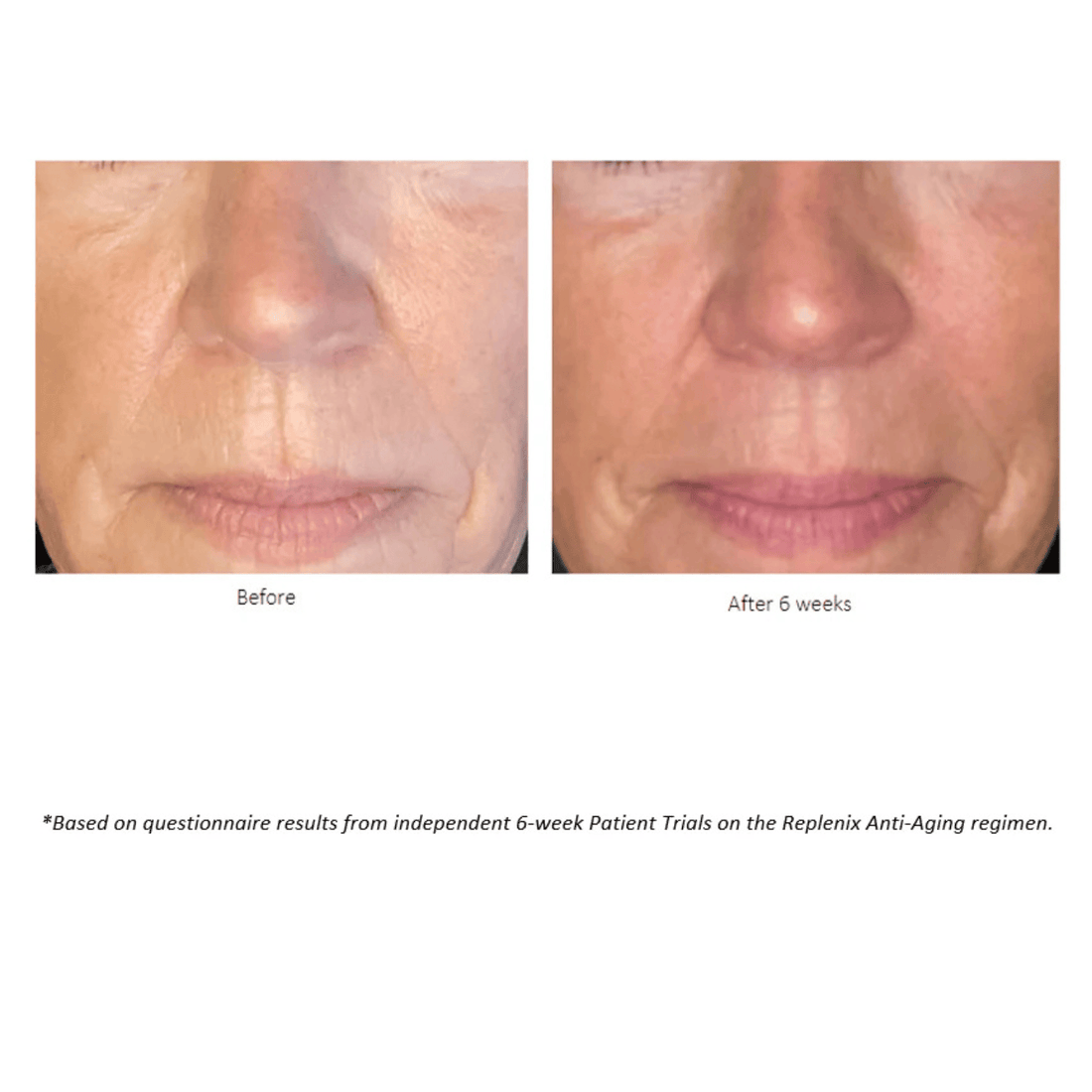 Replenix Face & Body Treatment 1 oz. Replenix Retinol 5X Regenerate Dry Serum - Skin Type Solutions
