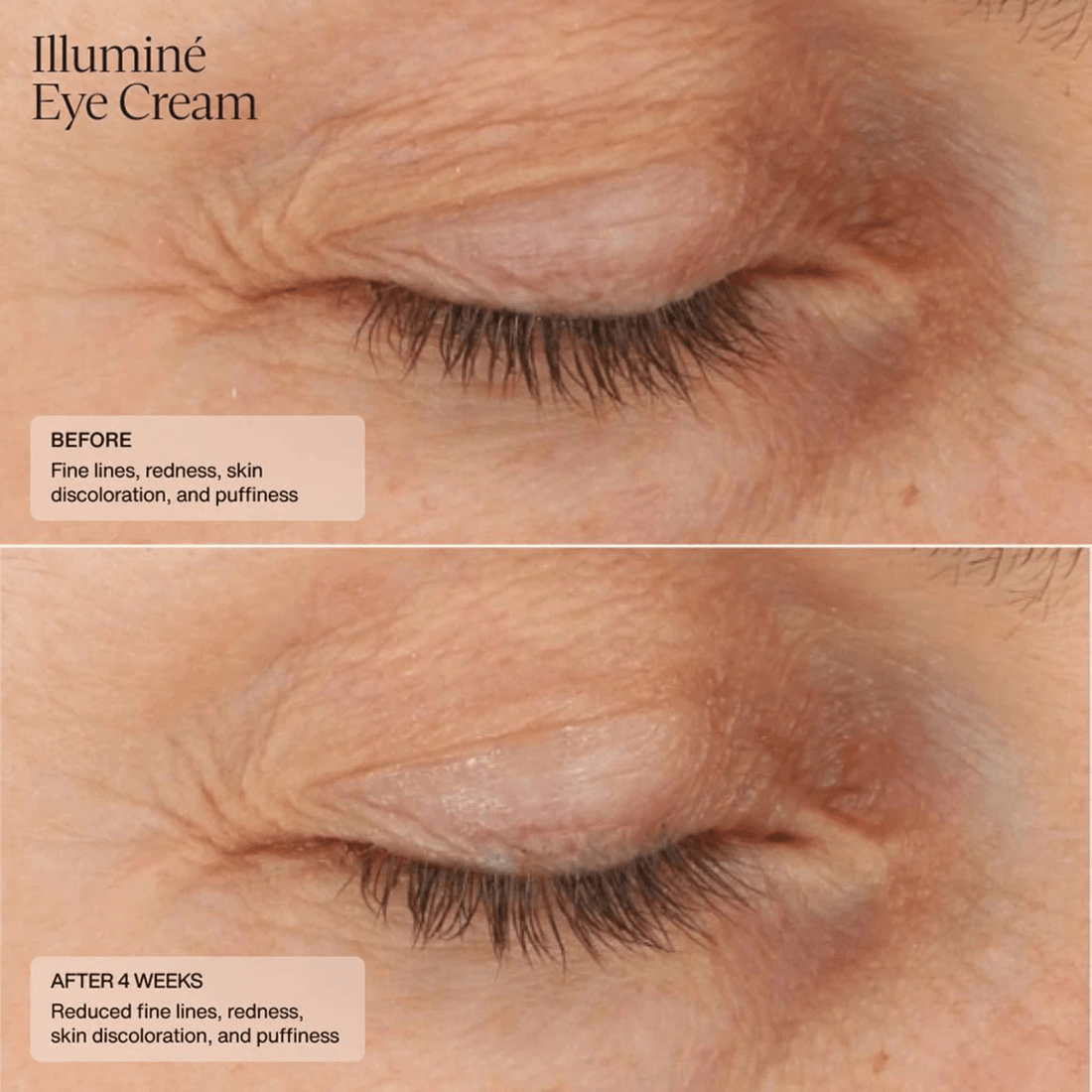 SENTE Eye Treatment 0.5 fl. oz. SENTE Illumine Eye Cream - Skin Type Solutions