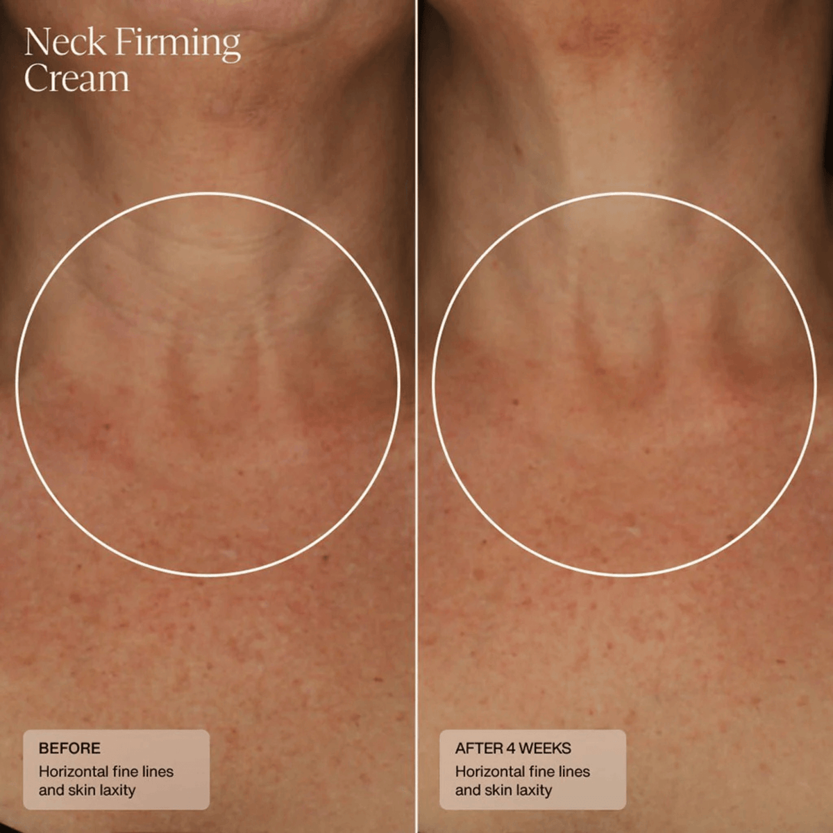 SENTE Face & Body Treatment 1.7 fl. oz. SENTE Neck Firming Cream - Skin Type Solutions