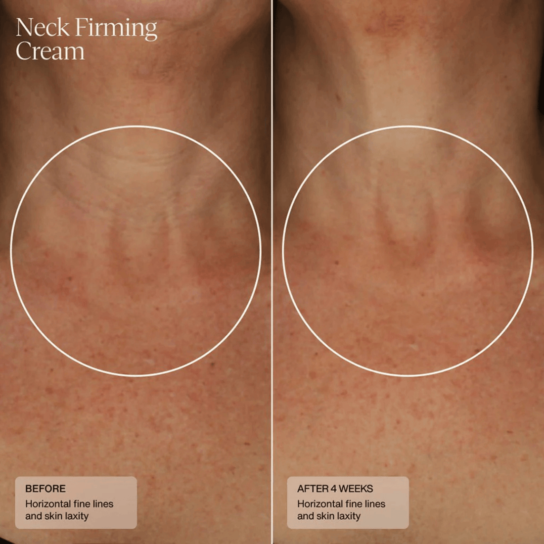 SENTE Face & Body Treatment 1.7 fl. oz. SENTE Neck Firming Cream - Skin Type Solutions