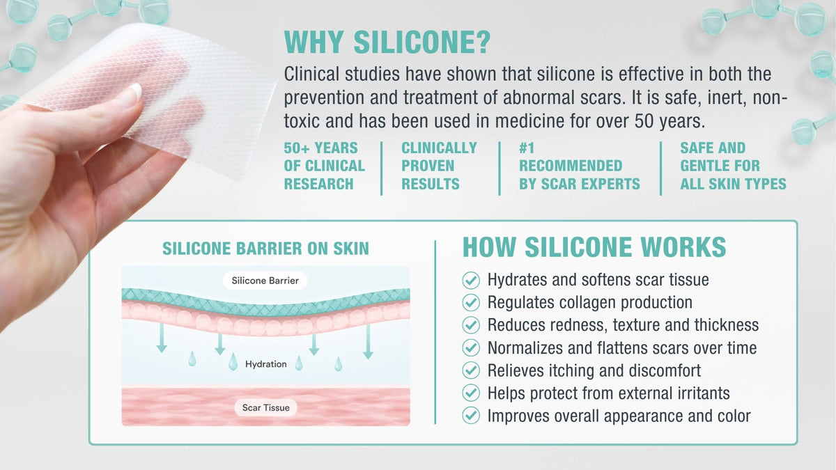 Silagen 100% Pure Silicone Gel banner