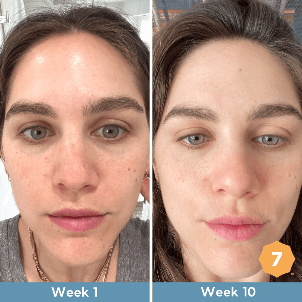Before and after a Skin Type Solutions routine