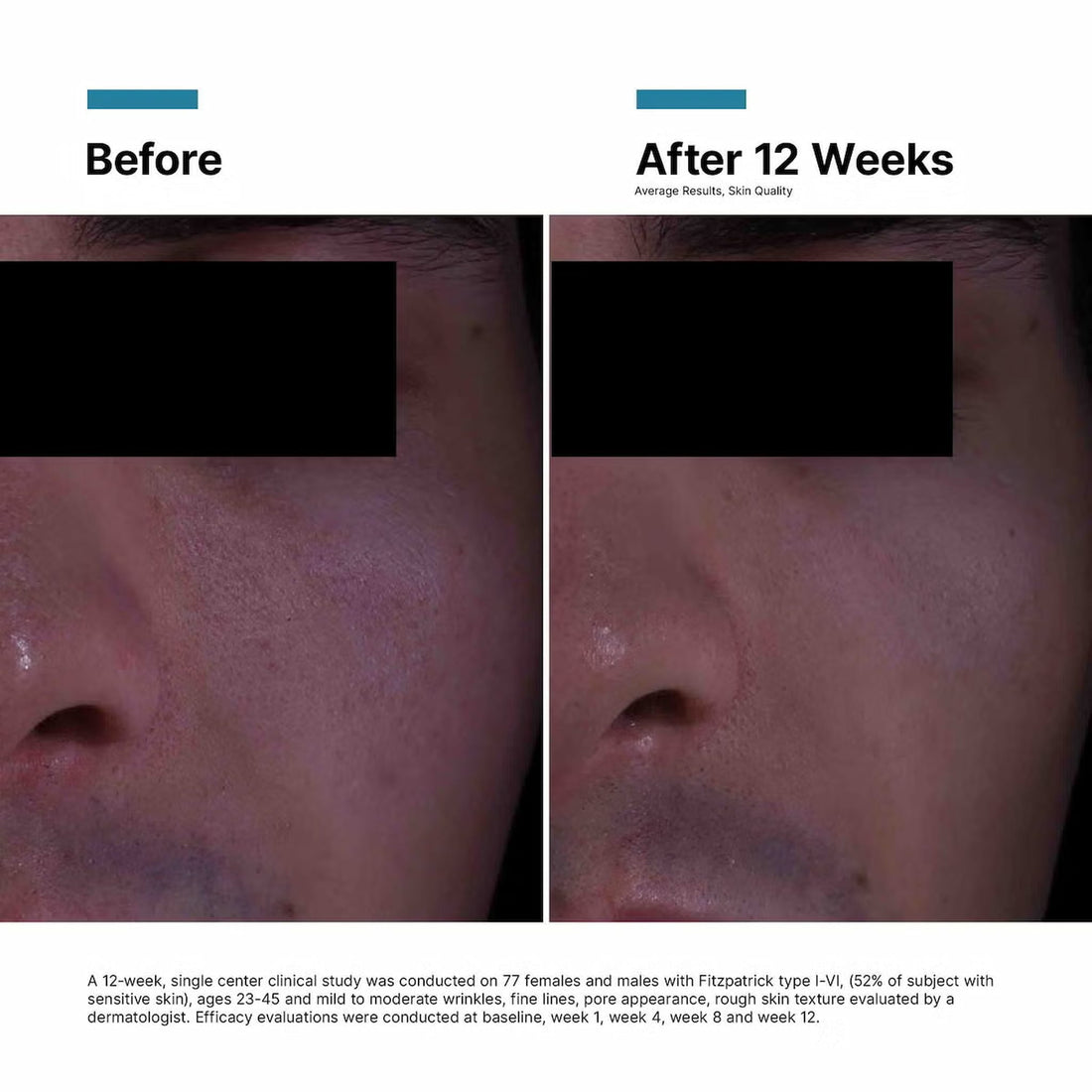 SkinCeuticals Treatments & Serums SkinCeuticals P-TIOX Anti-Wrinkle Cream - Skin Type Solutions