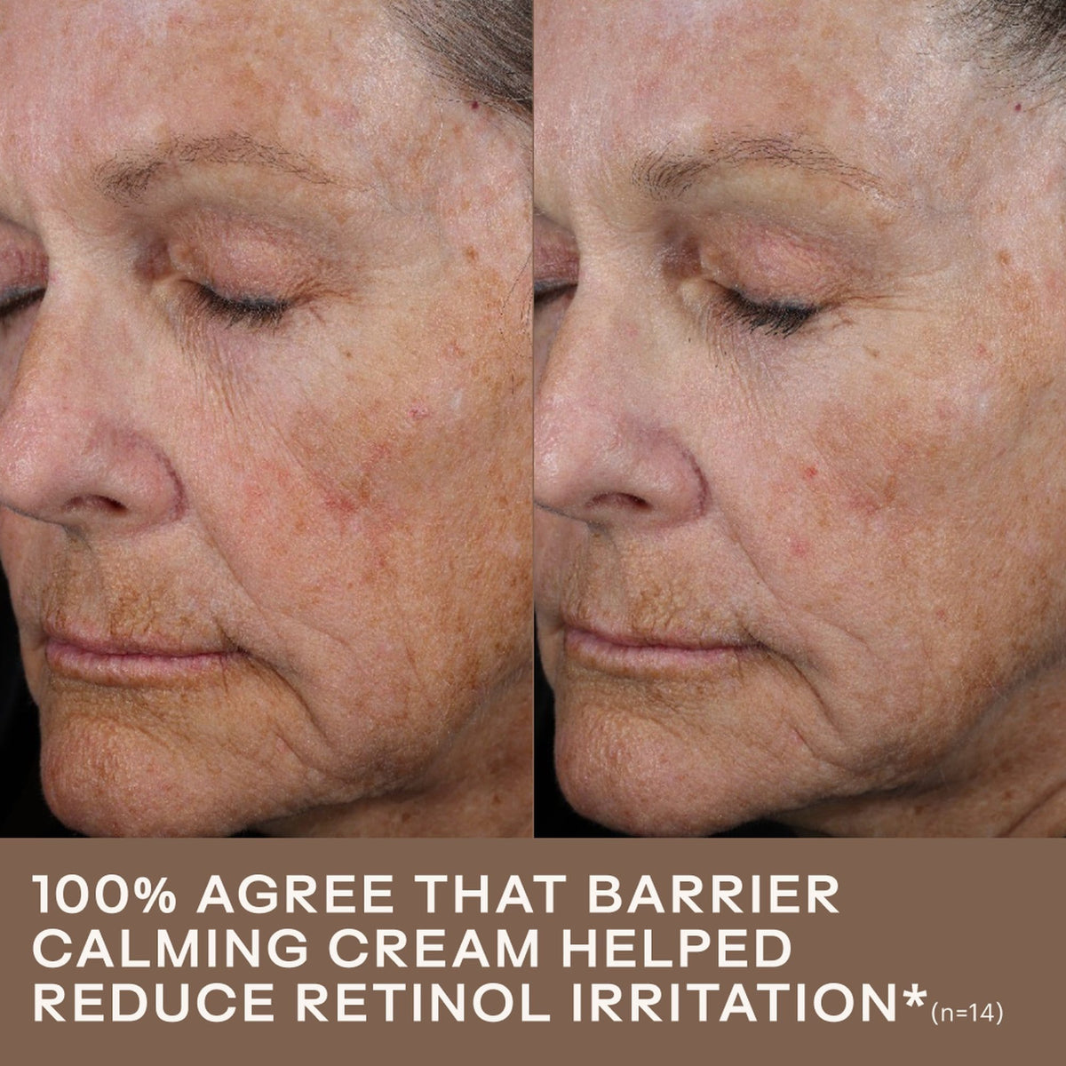 SkinMedica Face Moisturizers 1.7 fl. oz / 50ml SkinMedica Barrier Calming Cream - Skin Type Solutions