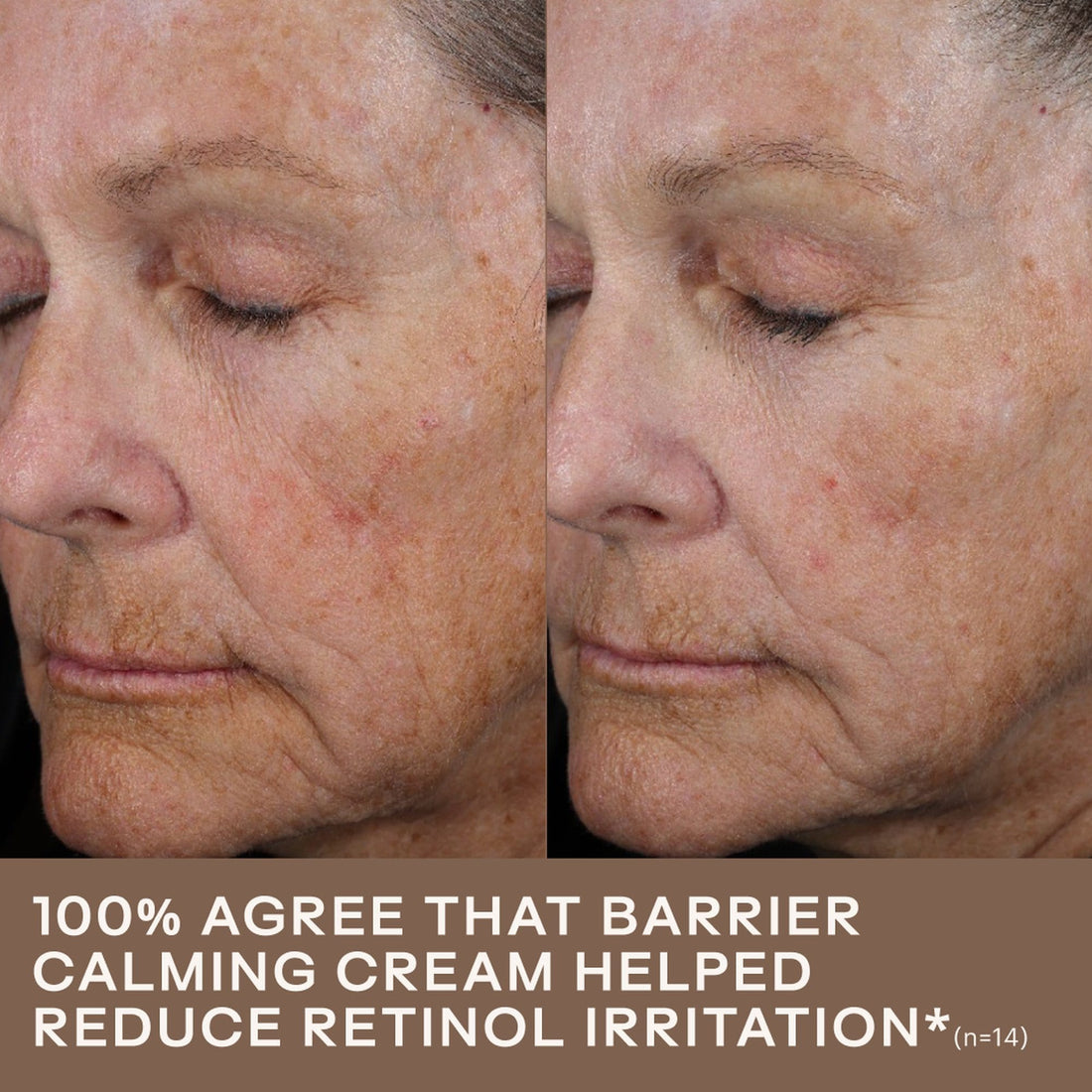 SkinMedica Face Moisturizers 1.7 fl. oz / 50ml SkinMedica Barrier Calming Cream - Skin Type Solutions