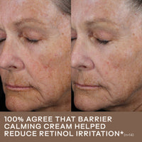 SkinMedica Face Moisturizers 1.7 fl. oz / 50ml SkinMedica Barrier Calming Cream - Skin Type Solutions