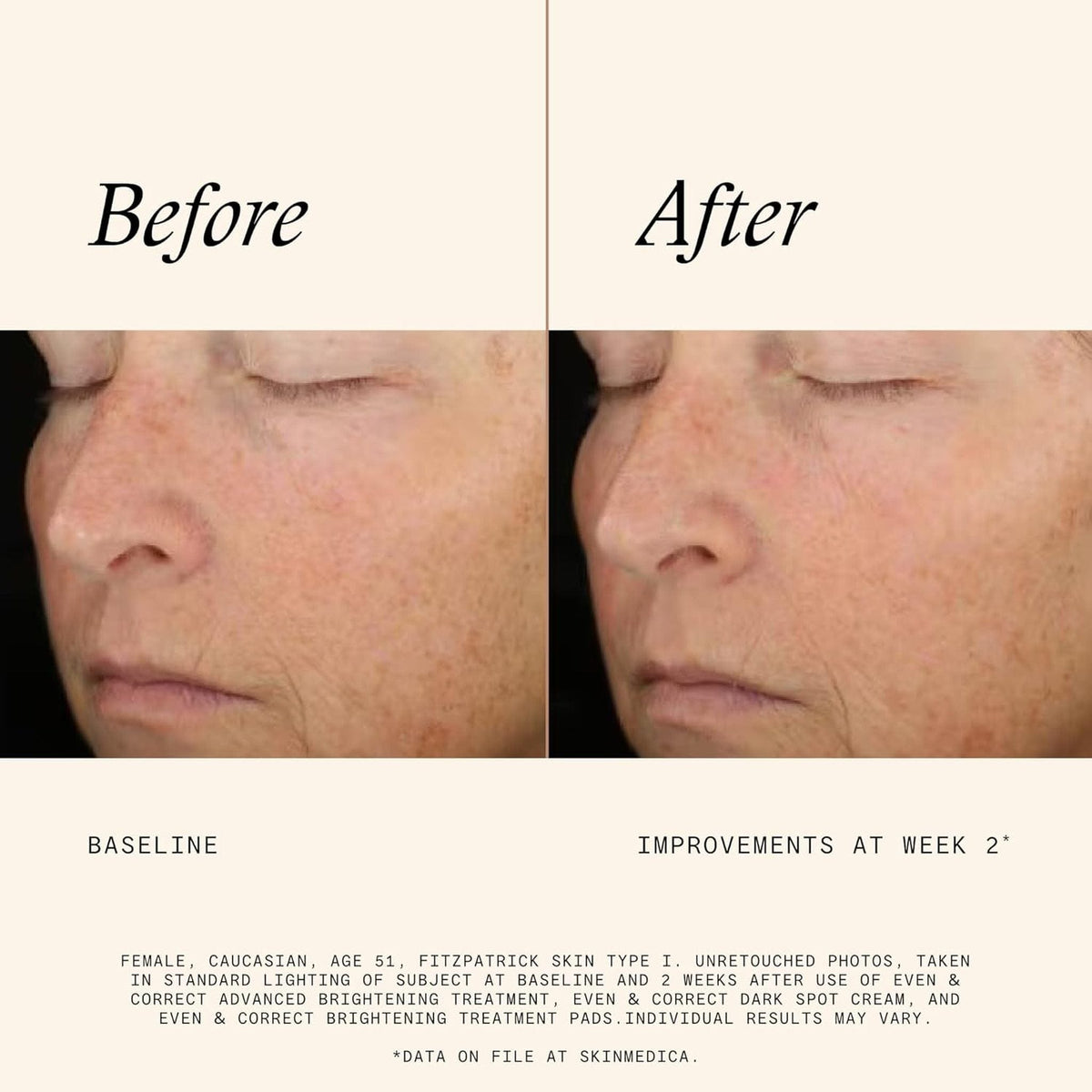 SkinMedica Facial Pads 60 Pads SkinMedica Even & Correct Brightening Treatment Pads - Skin Type Solutions