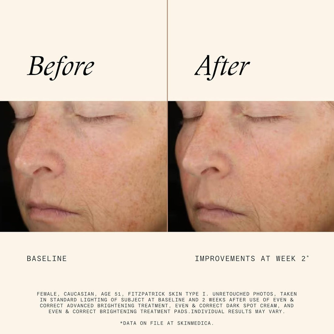 SkinMedica Facial Pads 60 Pads SkinMedica Even & Correct Brightening Treatment Pads - Skin Type Solutions
