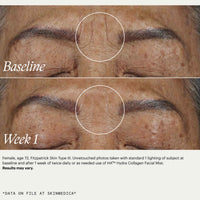 SkinMedica HA5 hydra collagen facial mist at skin type solutions before and after