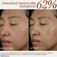 SkinMedica HA5 hydra collagen facial mist at skin type solutions before and after