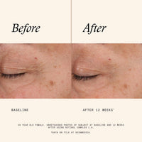 SkinMedica Face & Body Treatment 1 fl. oz. SkinMedica Retinol Complex 1.0 - Skin Type Solutions