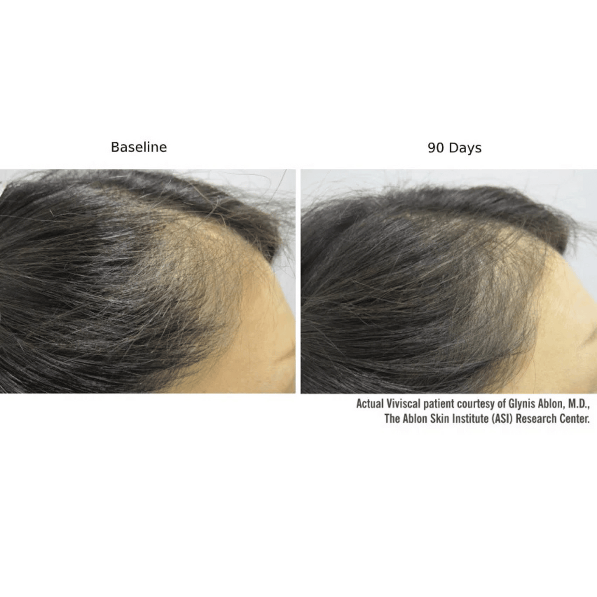 Viviscal Professional Hair Supplement Viviscal PRO Hair Growth Supplement - Skin Type Solutions