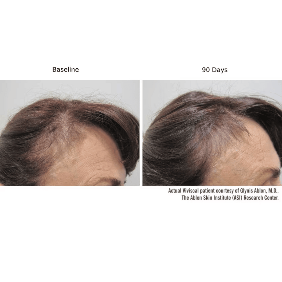 Viviscal Professional Hair Supplement Viviscal PRO Hair Growth Supplement - Skin Type Solutions