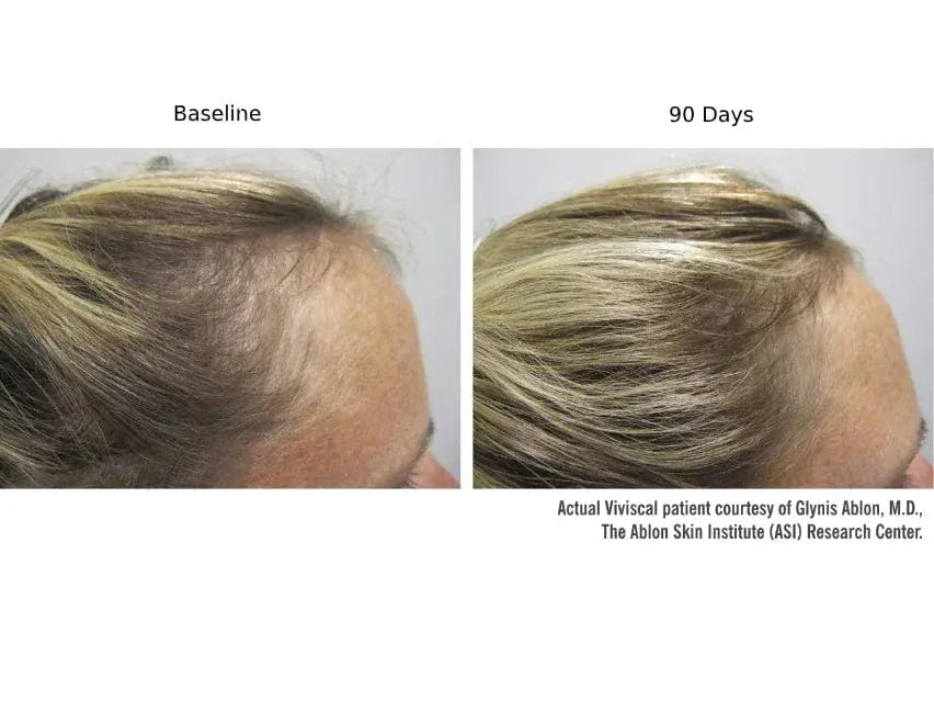 Viviscal Professional Hair Supplement Viviscal PRO Hair Growth Supplement - Skin Type Solutions