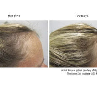 Viviscal Professional Hair Supplement Viviscal PRO Hair Growth Supplement - Skin Type Solutions