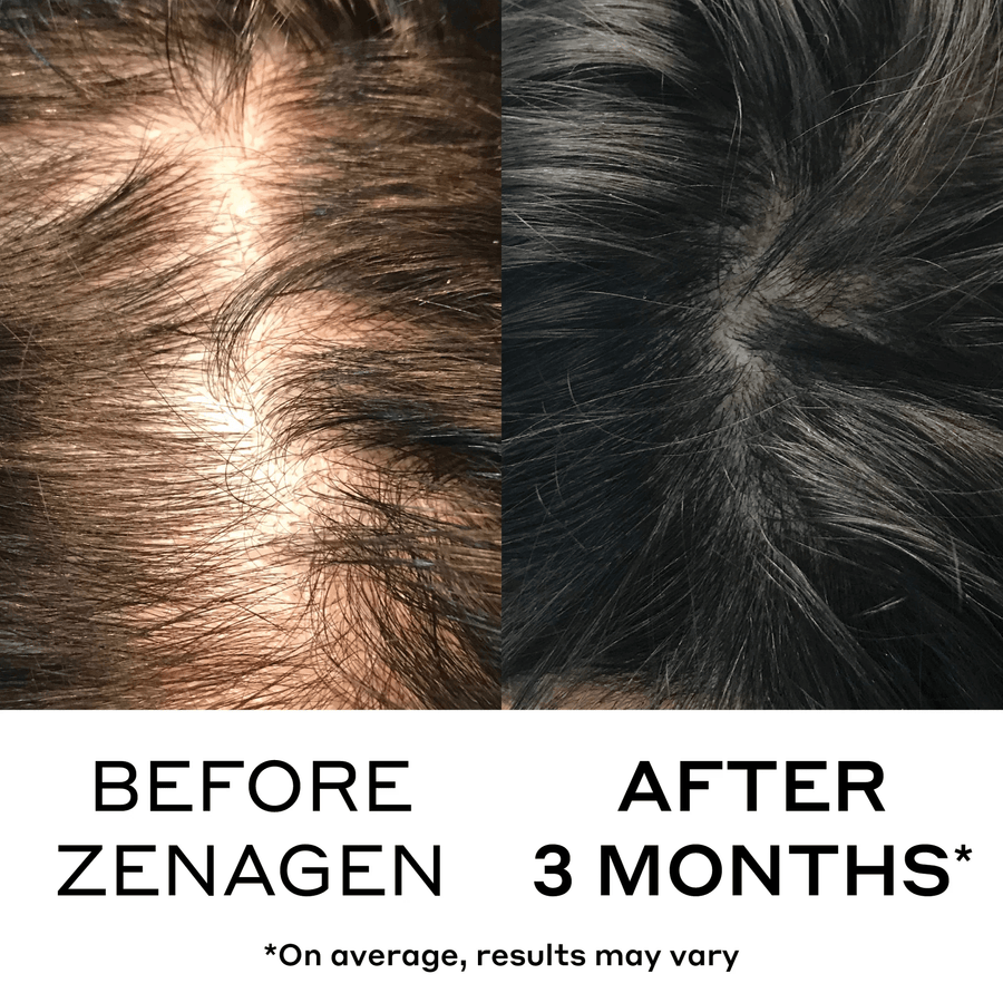 Zenagen Scalp Treatment Zenagen Densifying Hair Serum - Skin Type Solutions